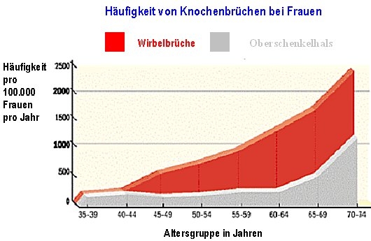 Knochenbrüche