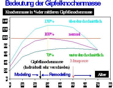 Osteoporose, Osteoporosezentrum München, Dr. med. Radspieler, Knochendichtemessung, Knochendichte, Diagnostik, Gipfelknochenmasse