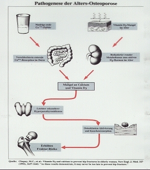 Osteoporose, Osteoporosezentrum München, Dr. med. Radspieler, Ursachen, Altersosteoporose, Sekundärer Hyperparathyreoidismus