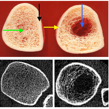 Differentialtherapie der Osteoporose in der Praxis