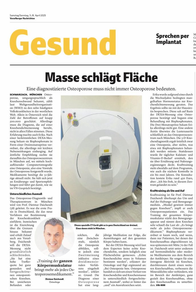 Masse schlägt Fläche